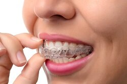 woman holding clear teeth aligners in mouth Invisalign Portland, OR